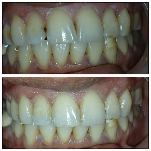 Pooja Smile Care Dental Gallery Image 22